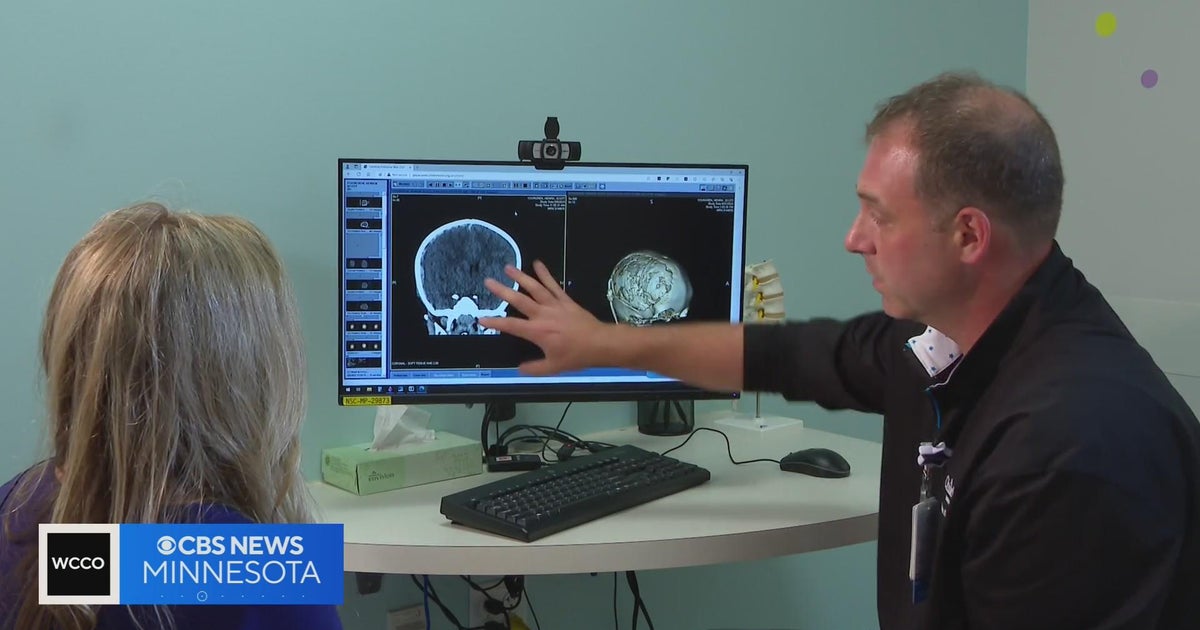 How a family in Waverly dealt with a terrible accident CBS Minnesota