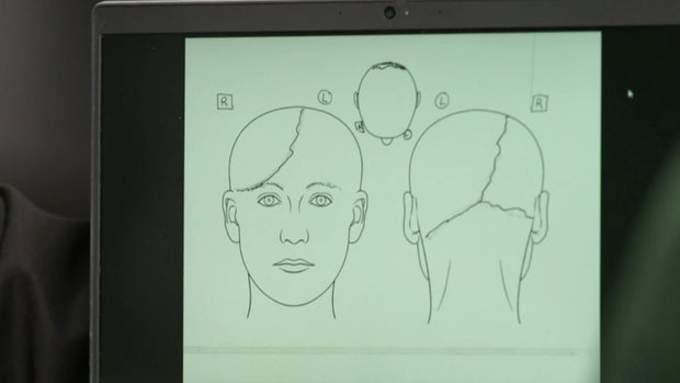 Steven Smith autopsy sketch