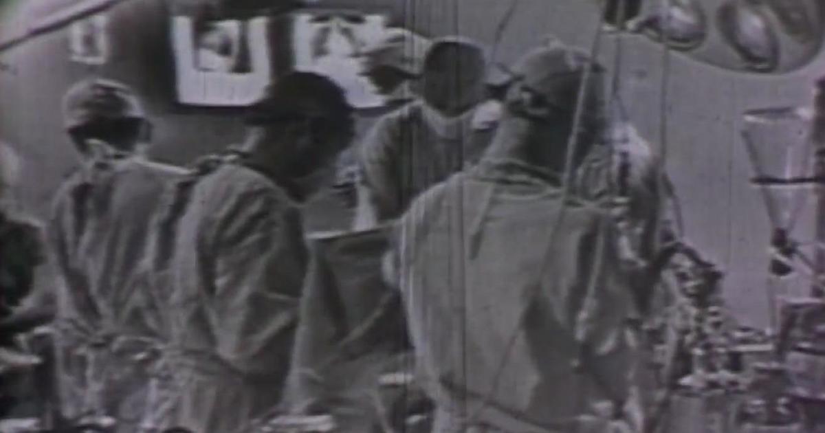 KPIX At 75: 1958 Live Historic Broadcast Shows Open Heart Surgery - CBS ...