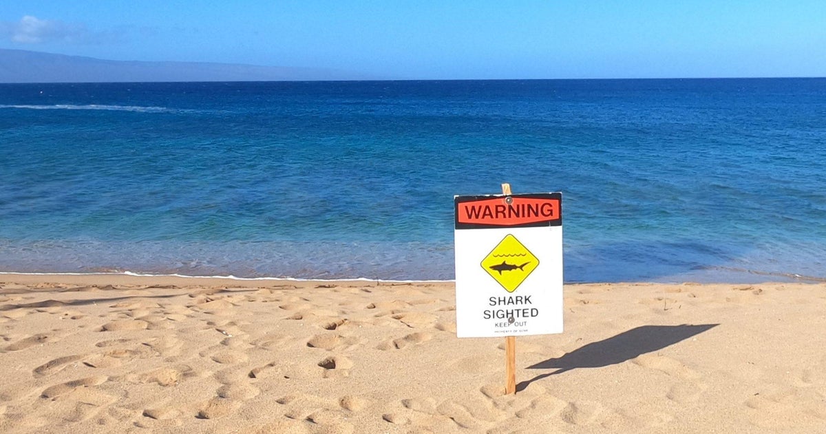Maui surfer loses part of leg in shark attack officials say  CBS News Maui surfer loses part of leg in shark attack officials say  CBS News