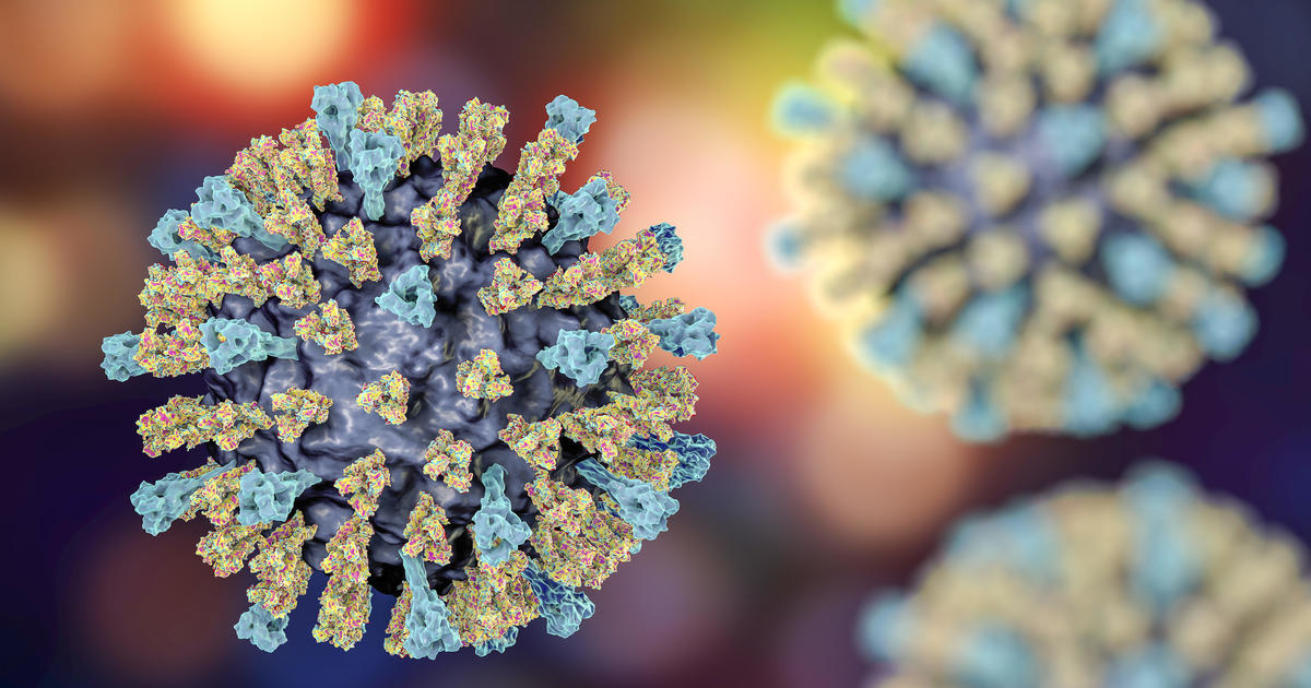Scenario of measles detected at Broward elementary faculty