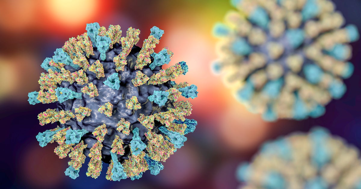 Scenario of measles detected at Broward elementary faculty Scenario of measles detected at Broward elementary faculty