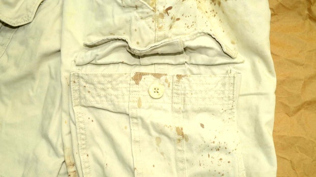 Dustin Parra's blood-spattered shorts.
