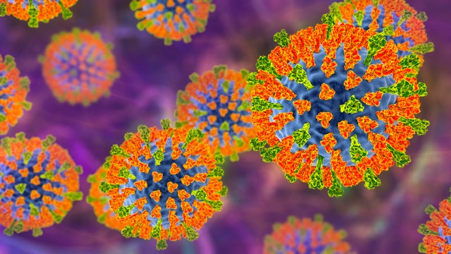 Measles virus, illustration 