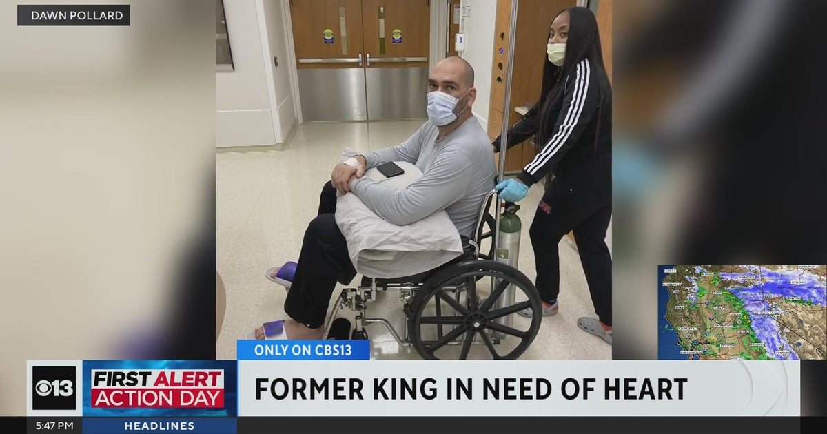 Scot Pollard, former Sacramento Kings player, in need of heart transplant