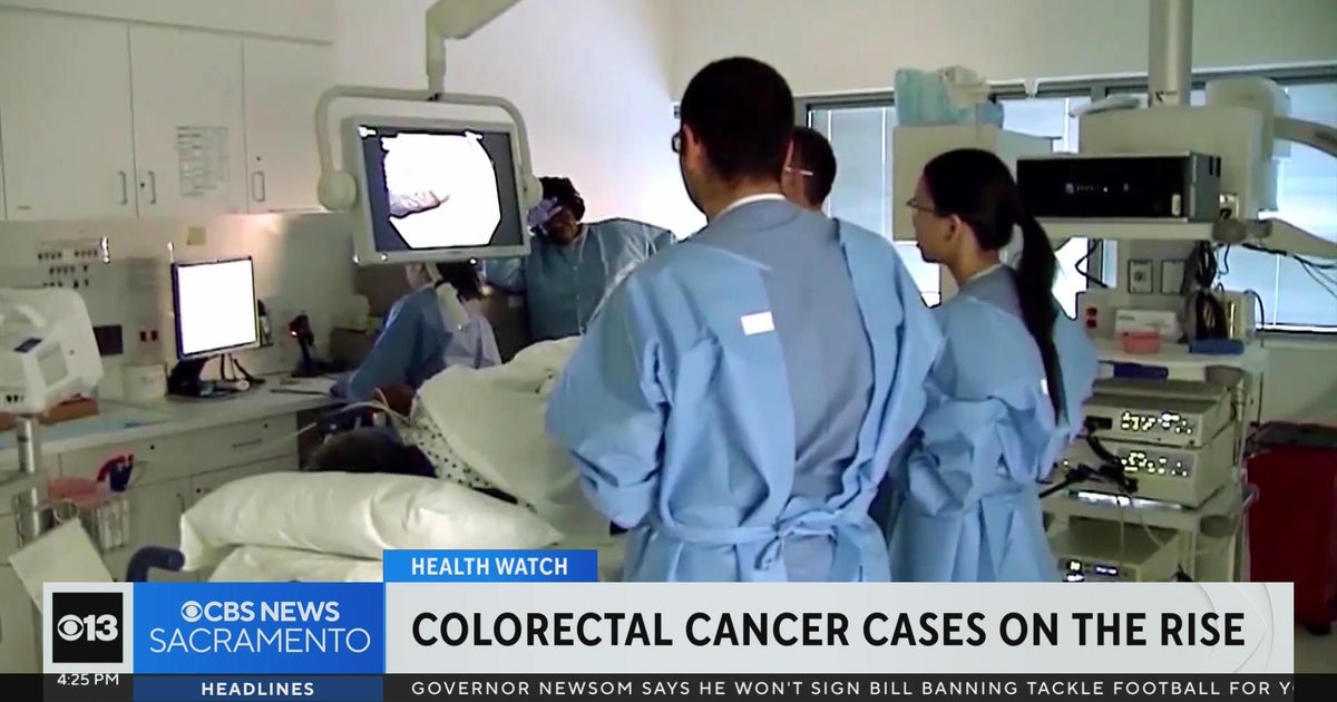 Sacramento survivor helps her story will help save lives from colorectal cancer