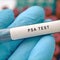 The prostate, and why it causes so many problems for men