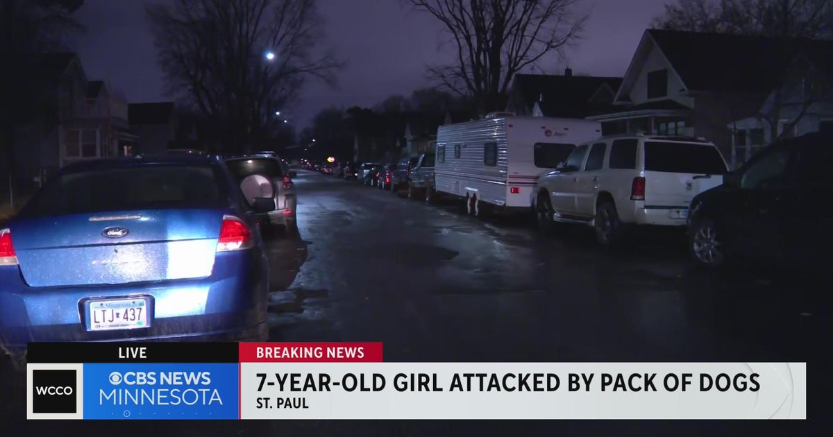 Young girl attacked by pack of dogs - CBS Minnesota