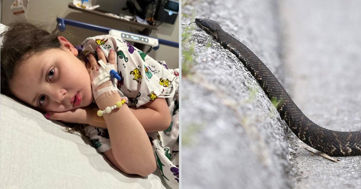 South Florida dad recounts frightful moments after daughter was bitten by water moccasin