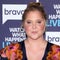 Amy Schumer says criticism of her face led to diagnosis