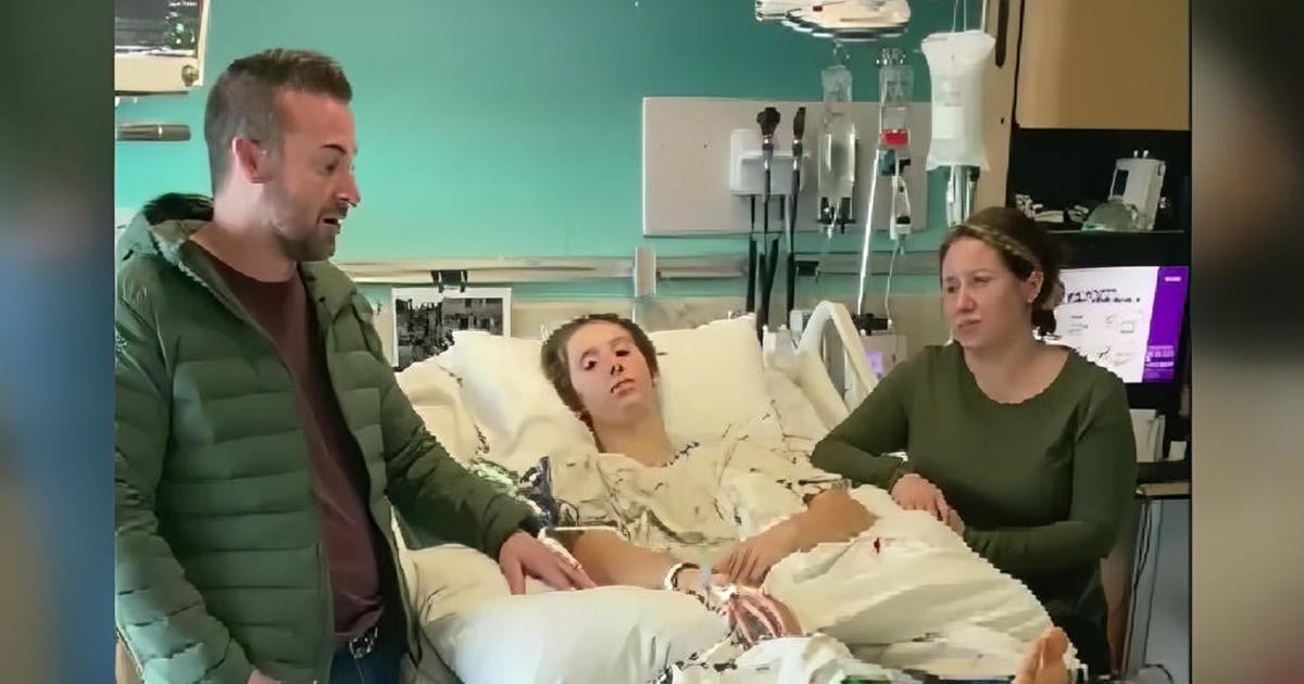 Napa teen severely injured in snowboarding accident - CBS San Francisco