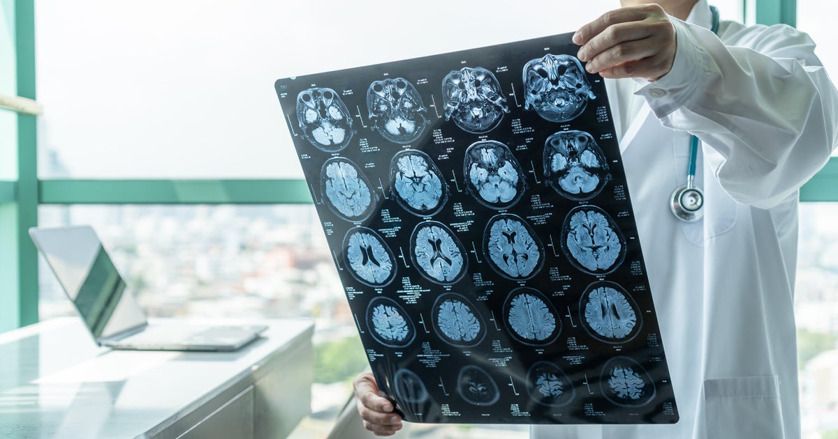 Why patients are waiting anxiously as medical imaging results take weeks to come back
