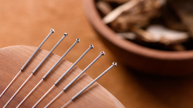 Acupuncture  needles 
