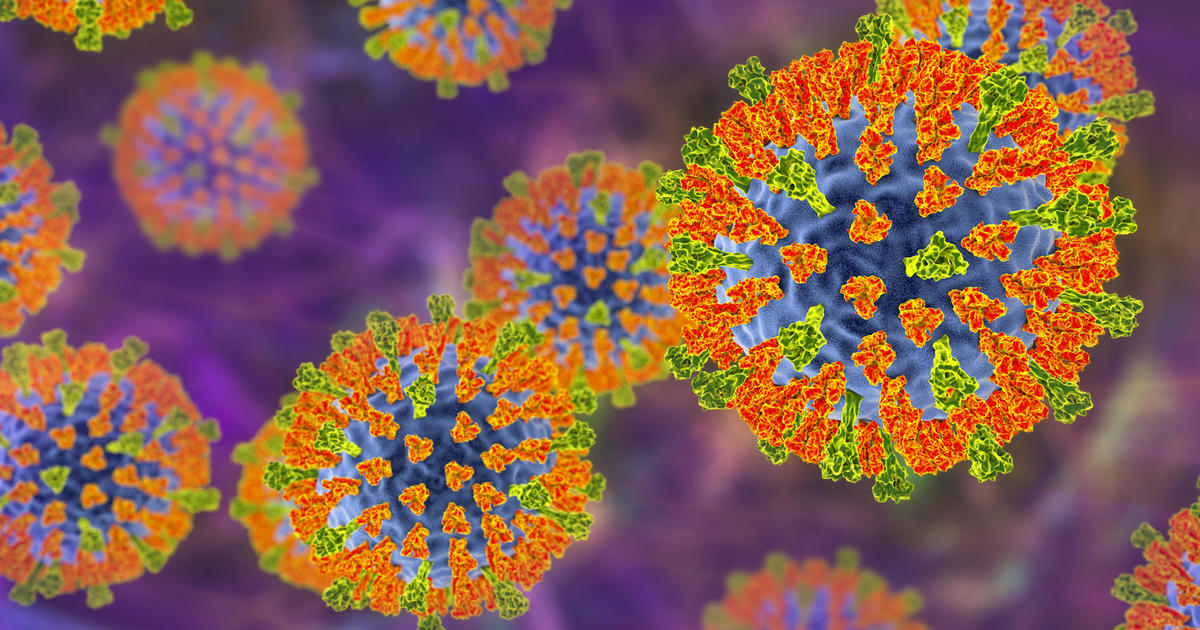 Cook County warns of measles outbreak at Sam's Club in southwest Chicago suburbs