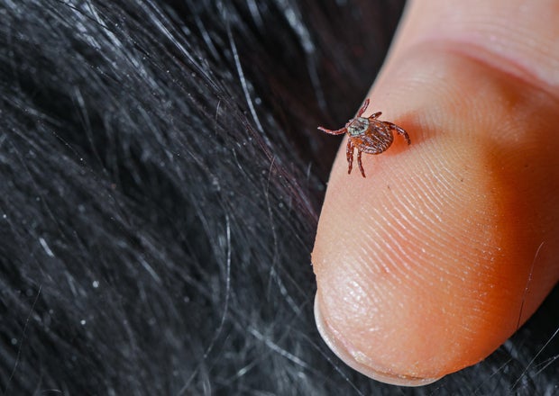 A small tick is seen on a person's finger