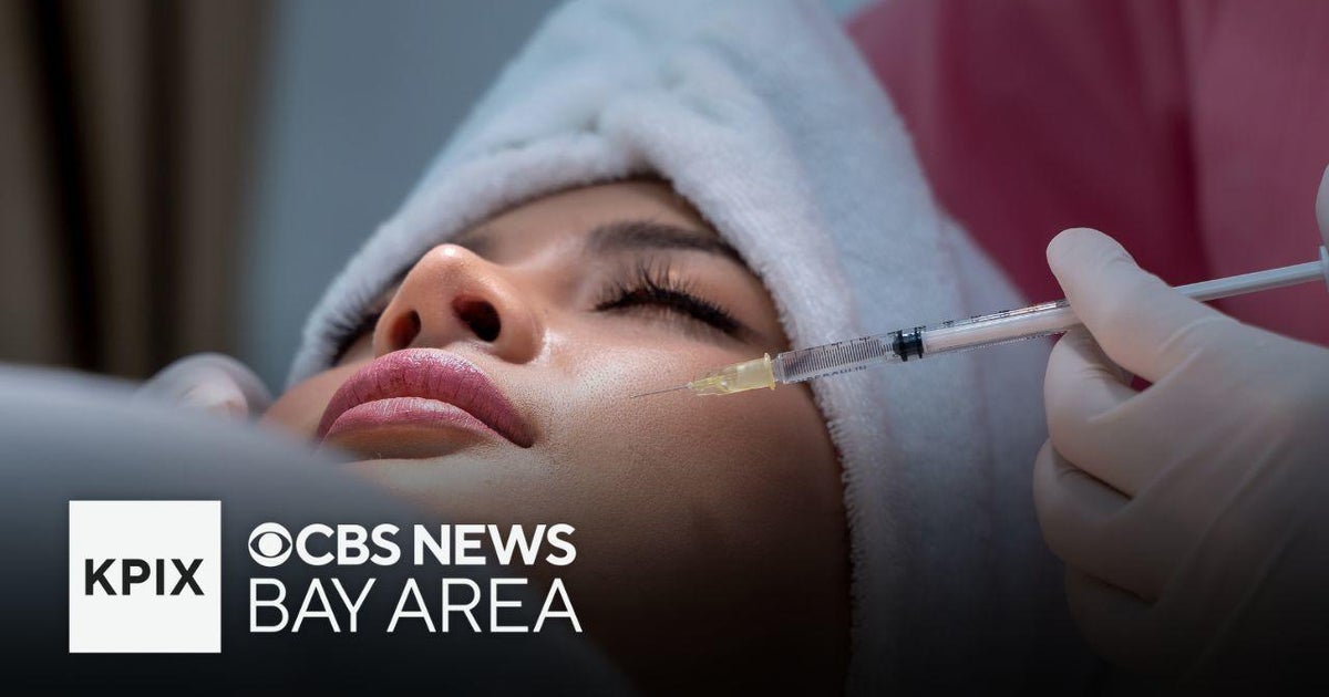Stanford doctor discusses counterfeit Botox tied to illnesses - CBS San ...