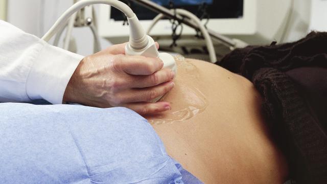 Obstetric sonography with research on monitor 