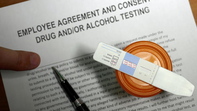 Employment Cannabis drug test 