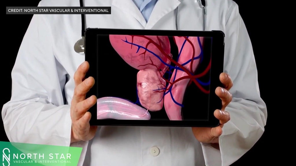 More men with enlarged prostates turning to less invasive treatment