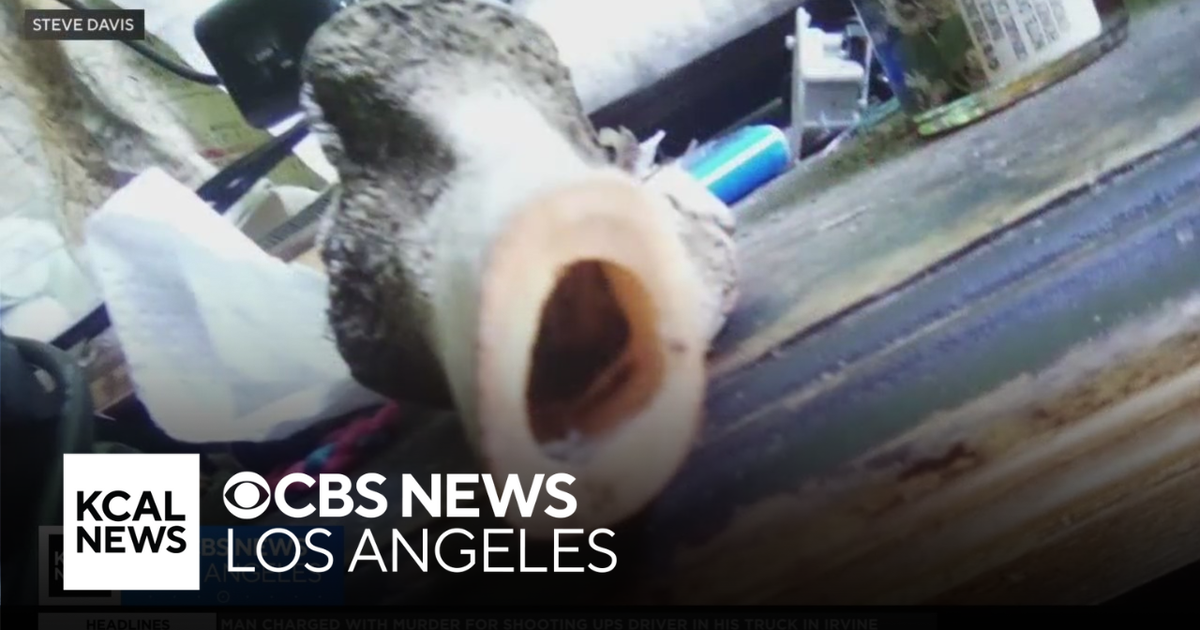 Skeletal human remains discovered at Loma Linda home - CBS Los Angeles