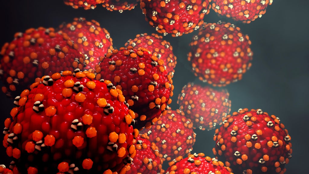Santa Cruz health officials report possible measles exposure