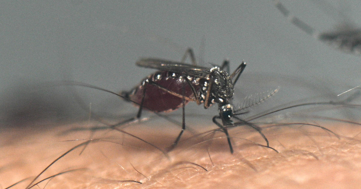 U.S. officials warn doctors about dengue as worldwide cases surge