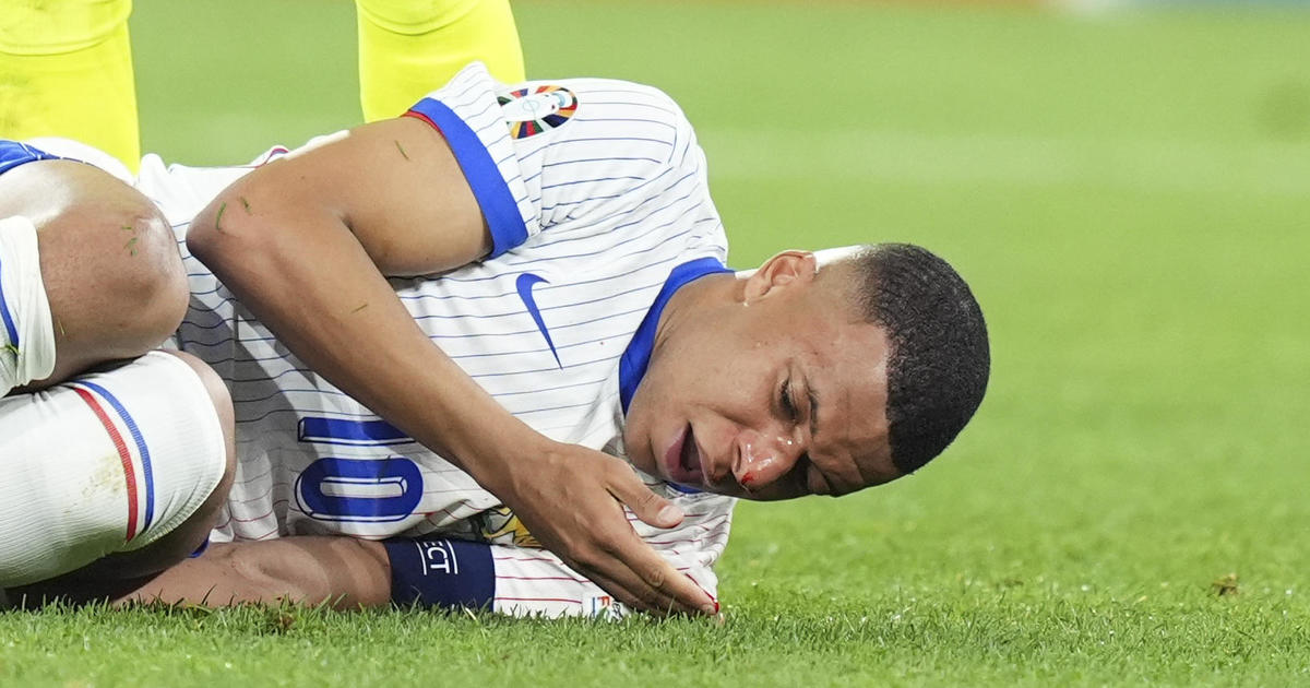 French soccer star Kylian Mbappé breaks nose in UEFA championship match