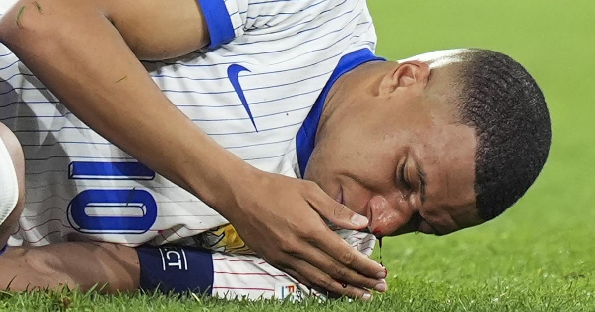 France s Kylian Mbapp Sufferers Broken Nose In Euro 2024 Match CBS News