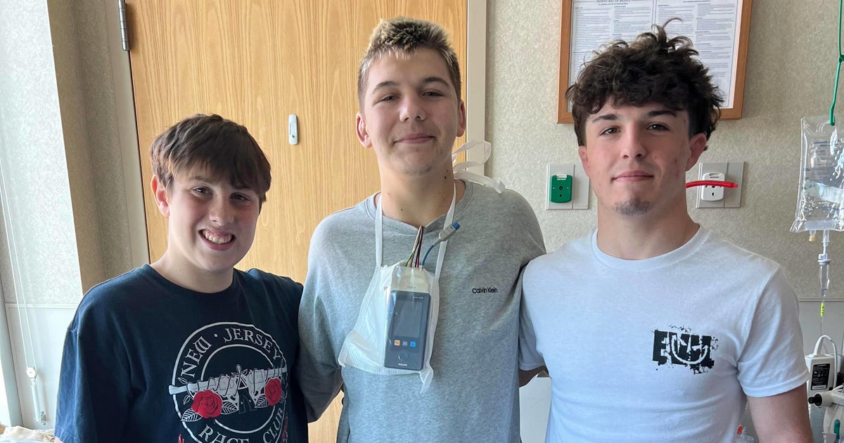 When a teenager’s heart stopped, his friends jumped into action — and their CPR training saved his life When a teenager’s heart stopped, his friends jumped into action — and their CPR training saved his life