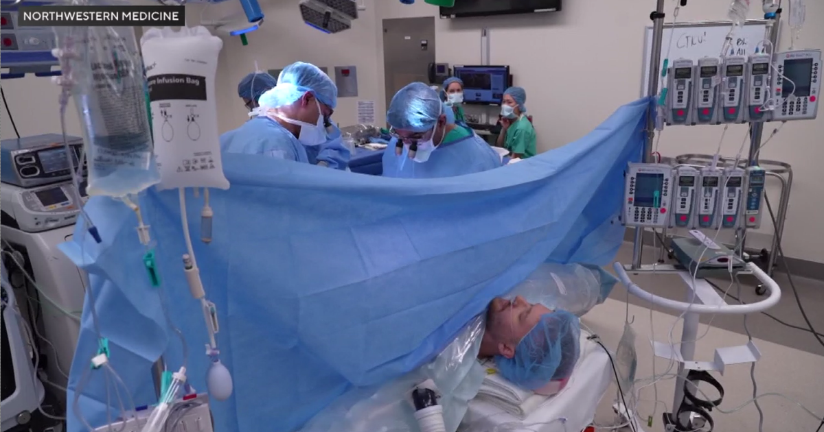 Groundbreaking Awake Kidney Transplant Performed at Northwestern Medicine
