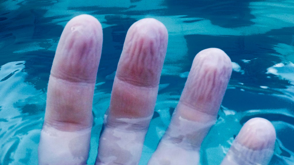 Why does water make our skin wrinkle?