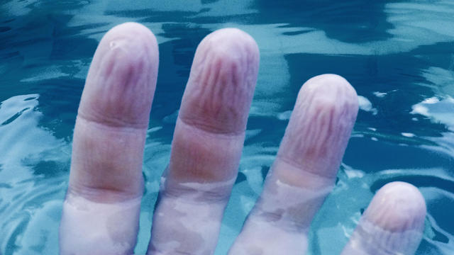 Human hand wrinkled and shriveled due to the long stay in the water 