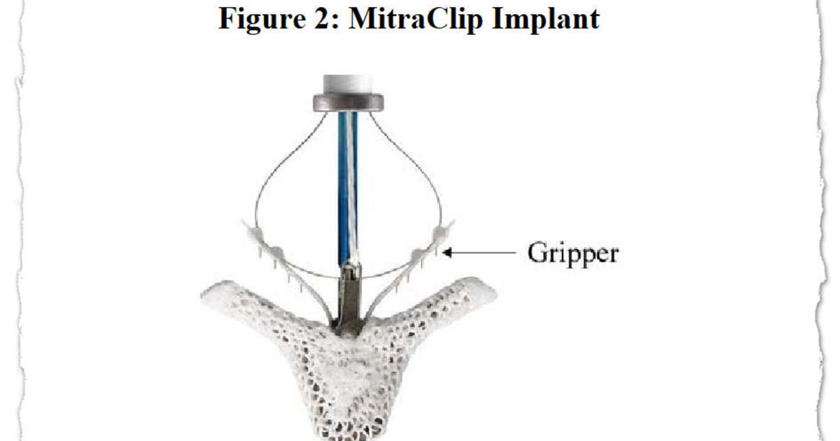 The FDA calls them "recalls," yet the targeted medical devices often remain in use