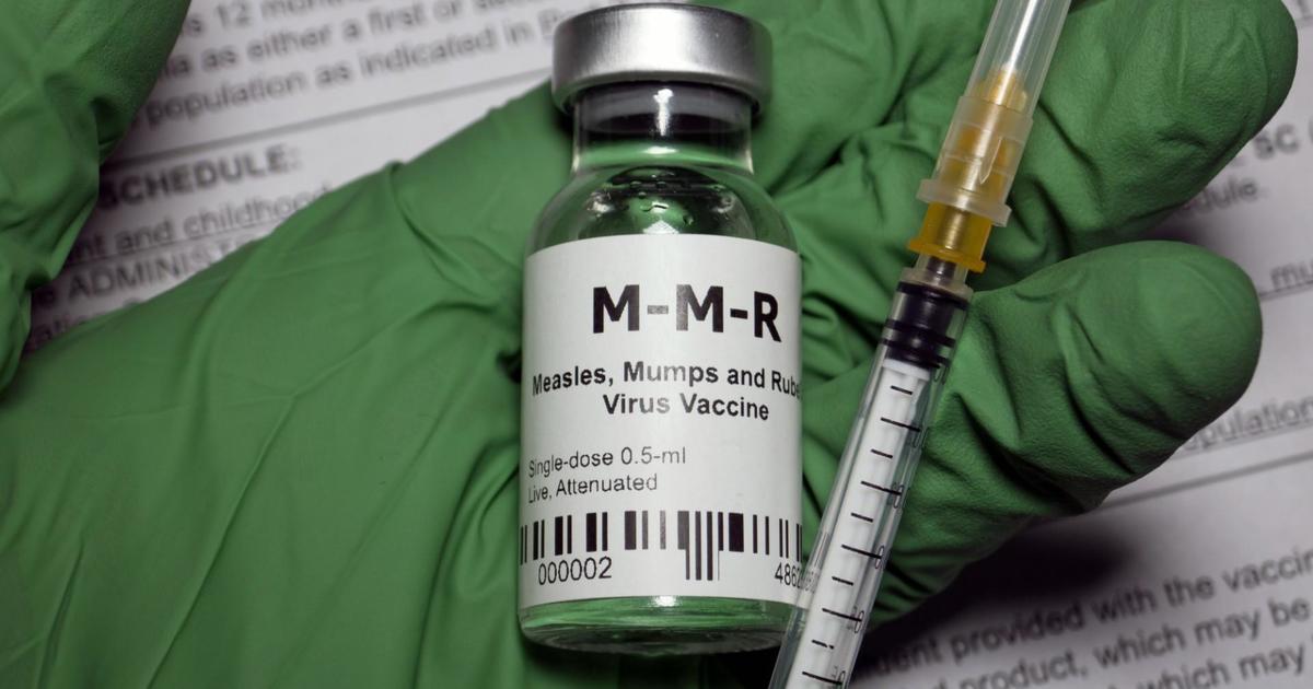 Measles case confirmed in Massachusetts for first time since 2020