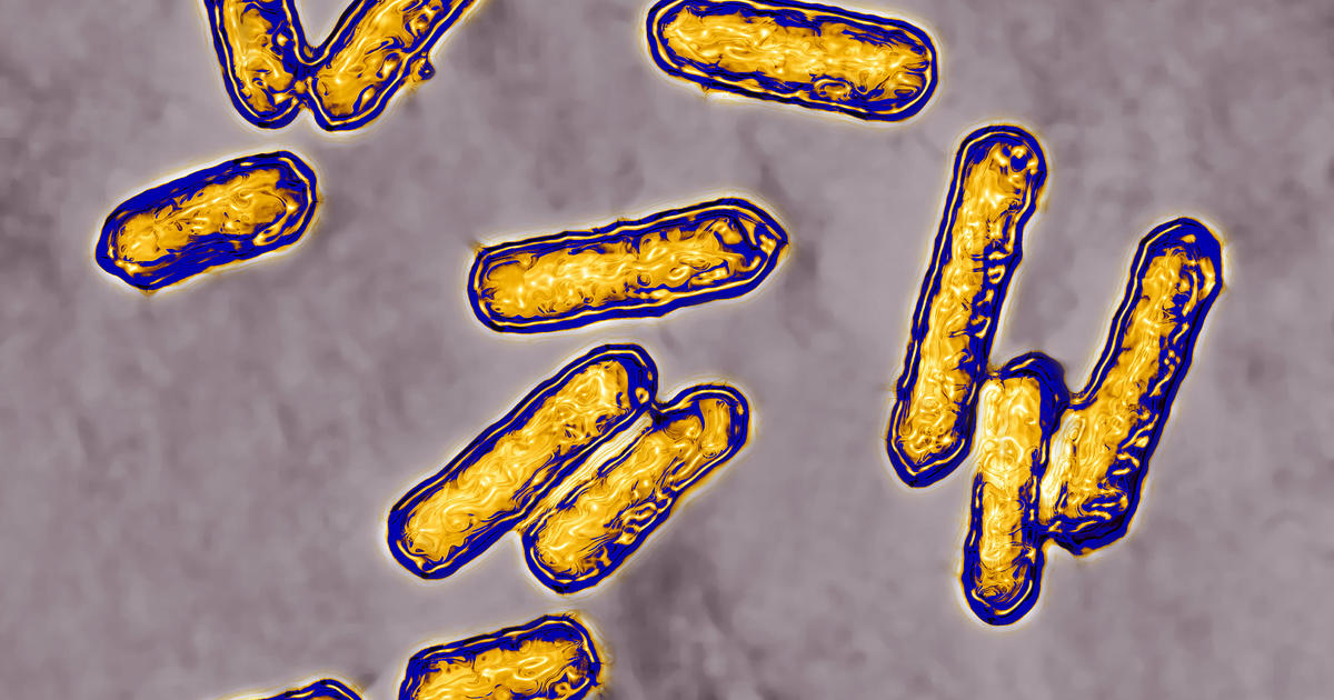 Щонайменше 7 людей у ​​Нью-Йорку були інфіковані бактерією Listeria, пов’язаною з м’ясними консервами.  Карта, що показує кількість випадків у різних частинах Сполучених Штатів