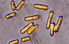 Listeria 