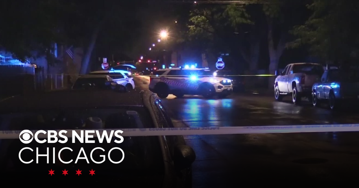 3-year-old boy grazed by bullet on Chicago's Northwest Side - CBS Chicago