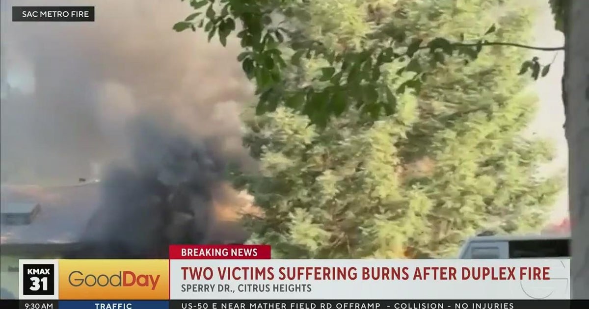 2 people suffer burns in duplex fire