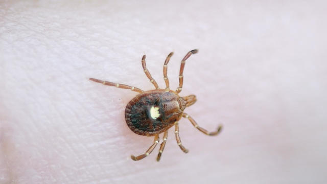 The fingers of the hand catch an encephalitis forest tick crawling on human skin. Danger of insect bite and human disease 