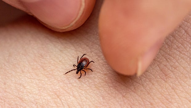 Rise in tick bites prompts Long Island school district to cancel outdoor recess