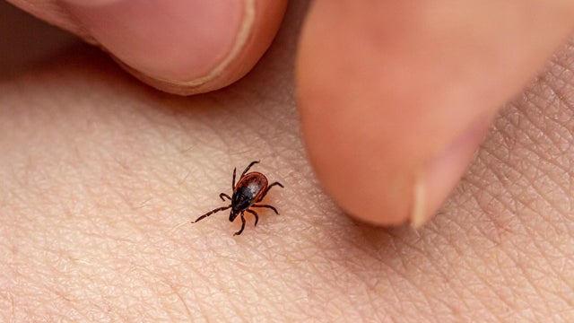 The fingers of the hand catch an encephalitis forest tick crawling on human skin. Danger of insect bite and human disease 