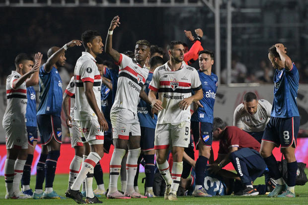 FBL-LIBERTADORES-SAOPAULO-NACIONALURU-IZQUIERDO-HEALTH 