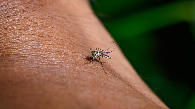 Mosquito bite, extreme close-up shot 