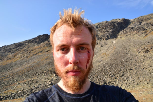 CORRIGIR ataque de águia norueguesa