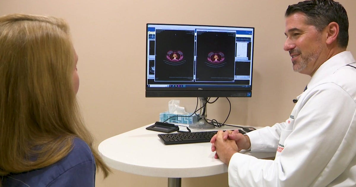 Customized cancer care gives South Florida woman hope after Stage 4 diagnosis Customized cancer care gives South Florida woman hope after Stage 4 diagnosis