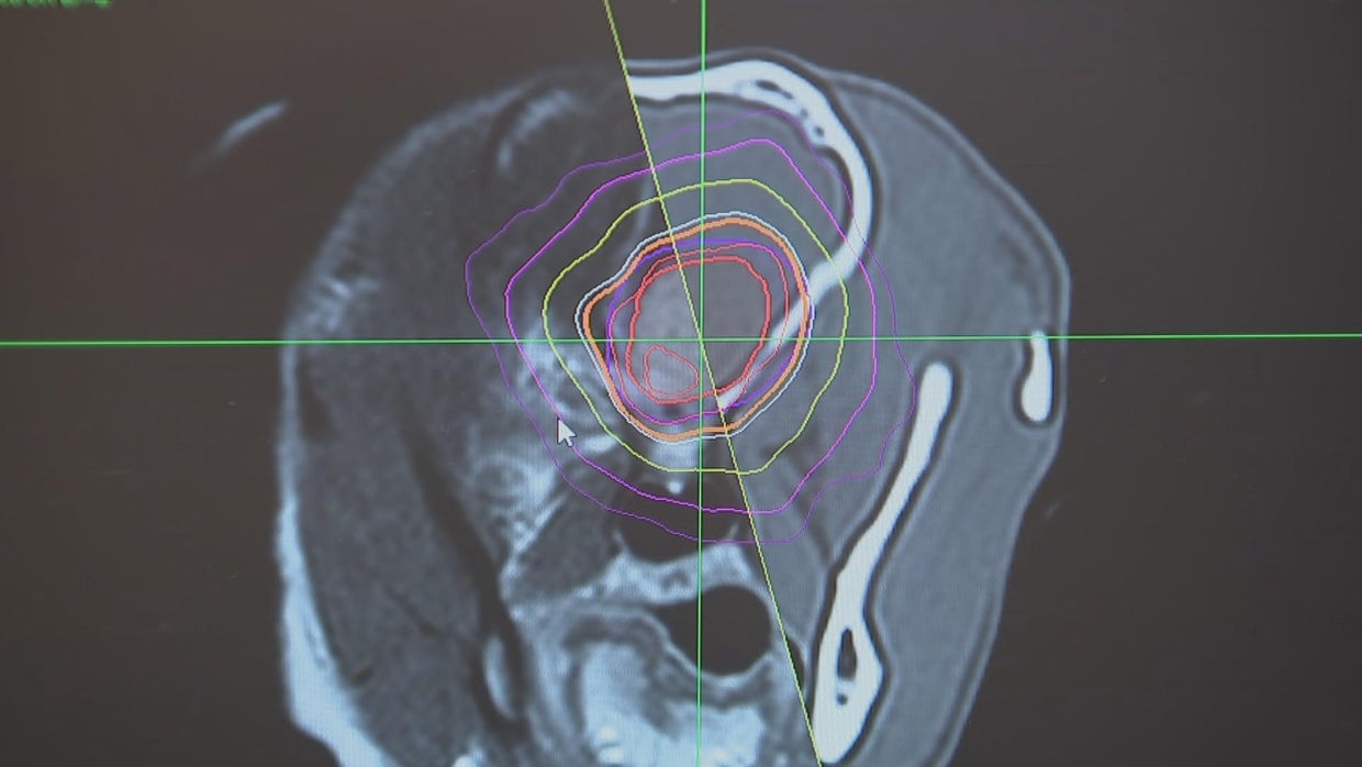 Pennsylvania vet offers world's only CyberKnife cancer treatment for