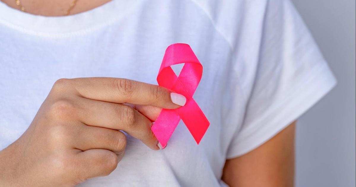 Doctor answers common breast cancer, mammogram questions