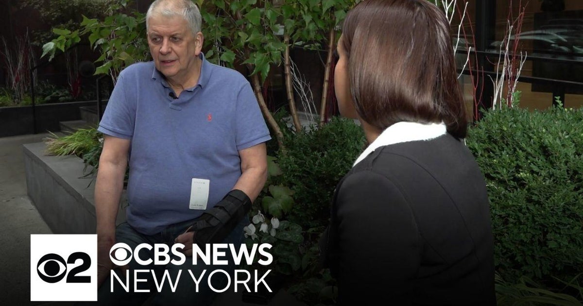 Elderly victim speaks out after random attack in NYC - CBS New York