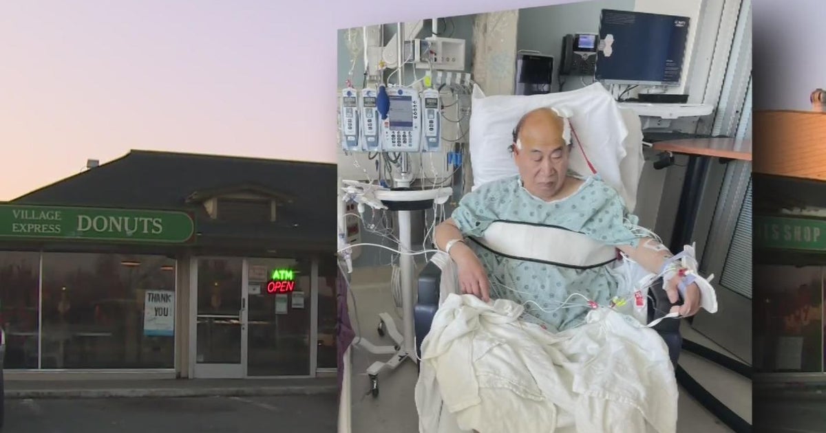 Community rallies behind Sacramento donut shop owner seriously injured in attack