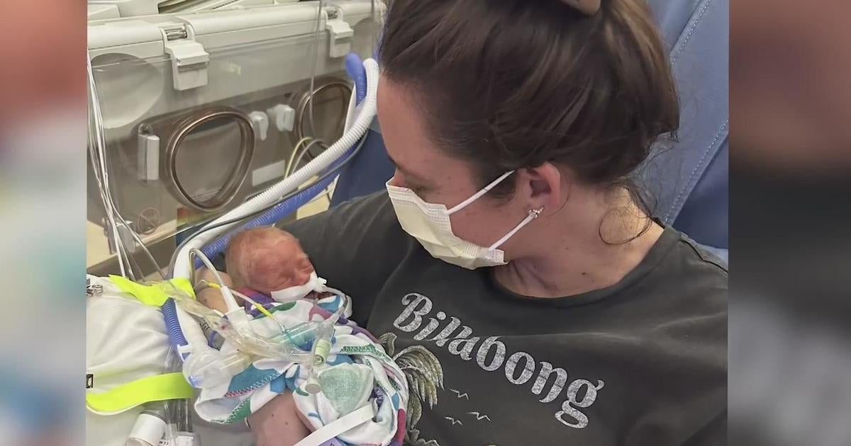 South Bay family raises awareness for "Kangaroo Care" for premature newborns